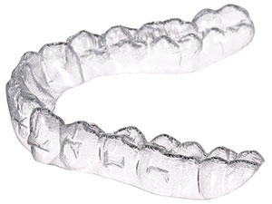 clear aligner